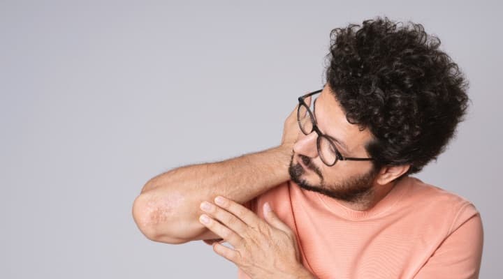 The Itch Factor: Understanding Common and Serious Causes of Itchy Skin and When to See a Dermatologist