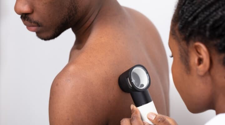 Who Should Get Screened for Skin Cancer and How Often?
